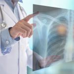 تشخیص زودهنگام سرطان ریه با کمک یک قطره خون!